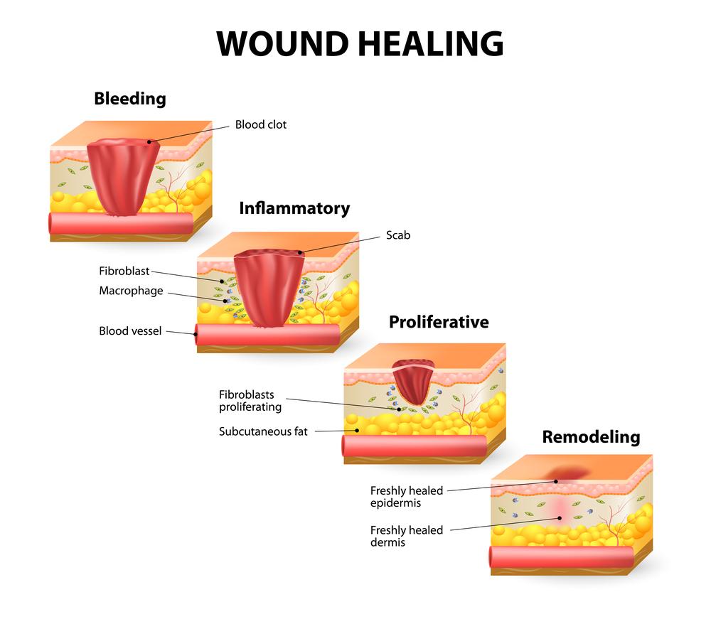 Essential Tools and Supplies for a Smooth Bleeding Process